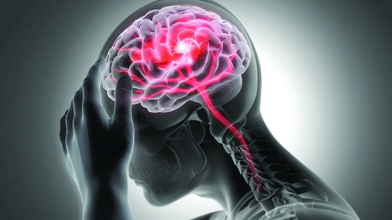Ilustración de una cabeza de perfil con el cerebro y vasos sanguíneos resaltados en rojo